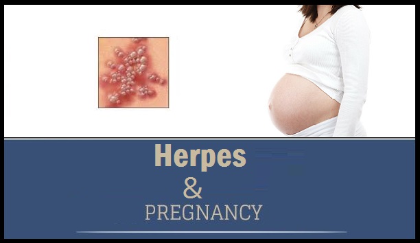 Does Herpes Affect Pregnancy